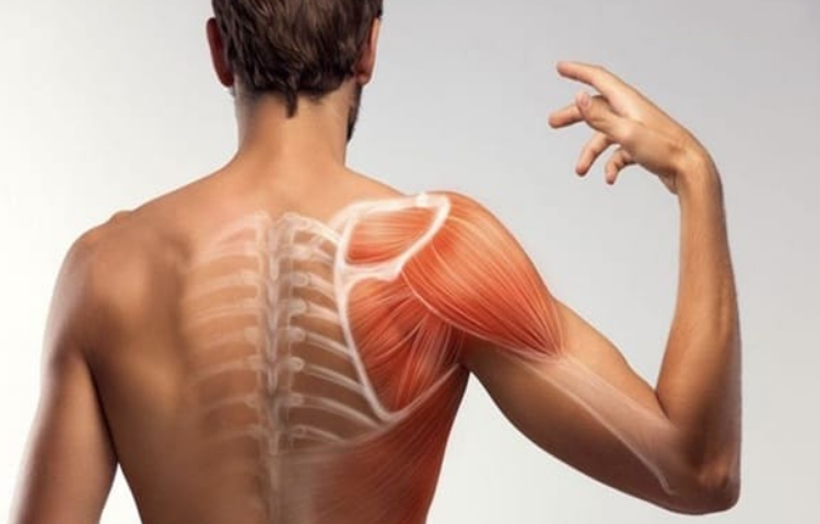 Điều trị hội chứng cổ vai cánh tay (chứng tý) bằng y học cổ truyền